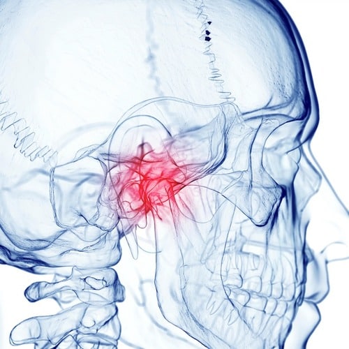 Kiefergelenks-Erkrankungen behandeln bei P4 Die Zahnärzte Berlin