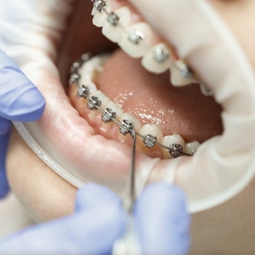 Kieferorthopädie Berlin Hohenschönhausen P4 Zahnärzte und Kinderzahnärzte