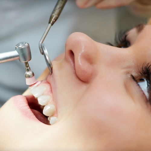 Kosmetische Zahnreinigung Berlin Hohenschönhausen - P4 Die Zahnärzte und Kinderzahnärzte