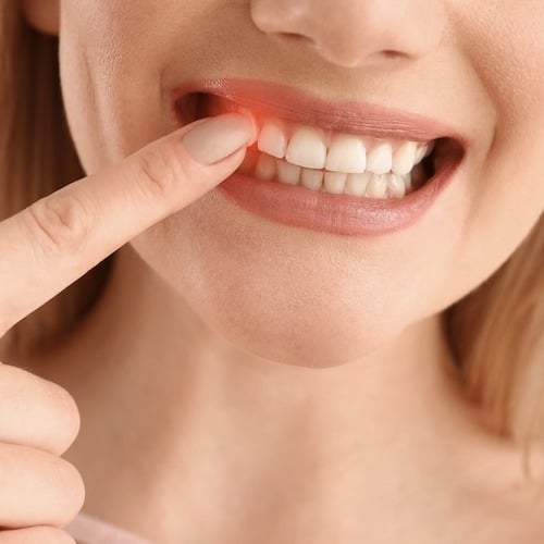 Parodontologie Berlin Hohenschönhausen - Parodontose schonend behandeln