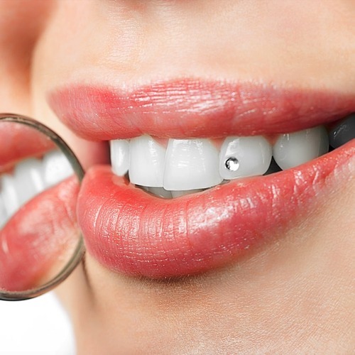 Zahnschmuck Berlin Hohenschönhausen - P4 Die Zahnärzte